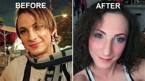 Richard Troy. . Mtf hormone effects in pictures